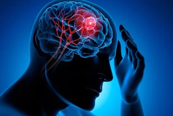 Brain Tumor