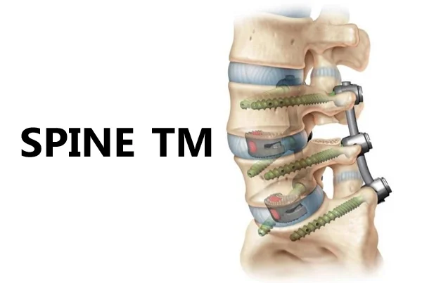 Spine Tm